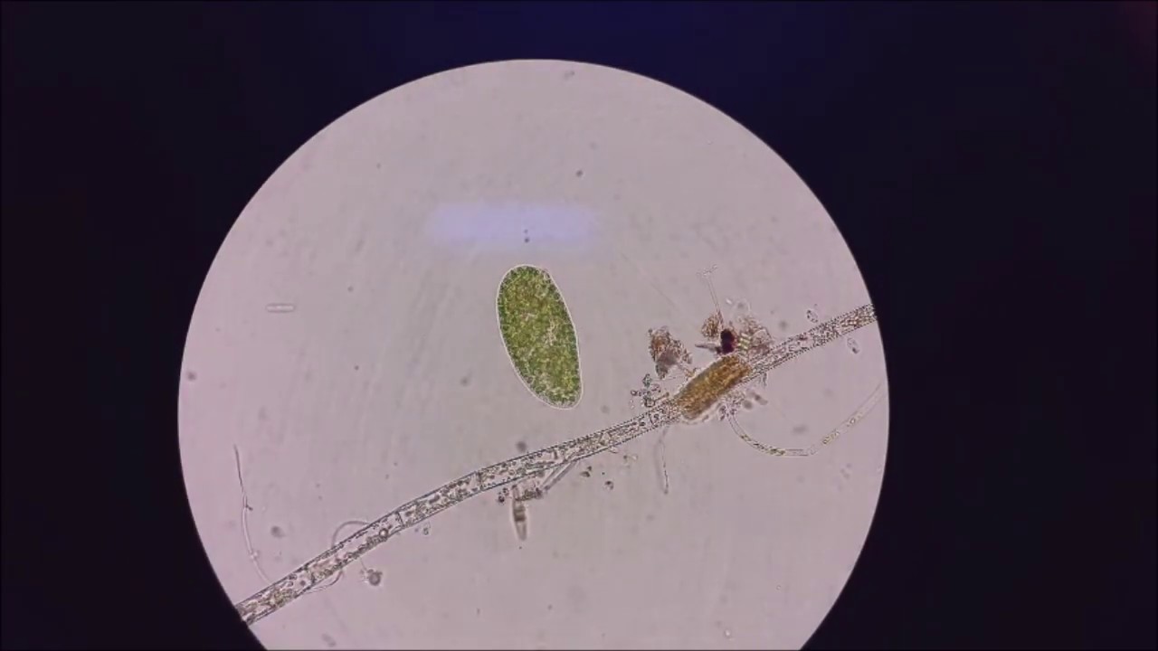 agua de charco en el microscopio