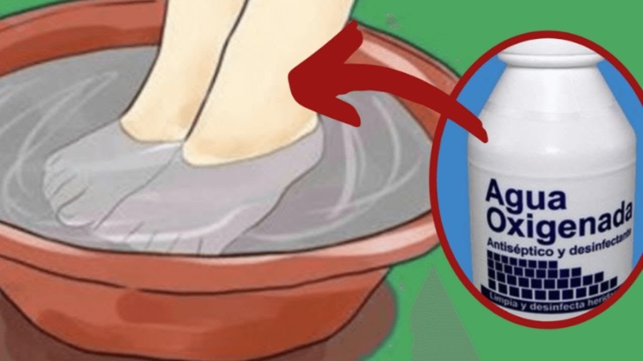 agua oxigenada para los hongos