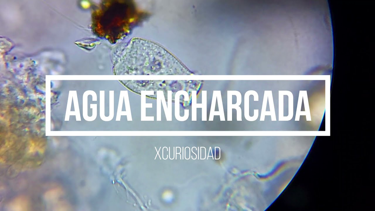 agua sucia bajo el microscopio