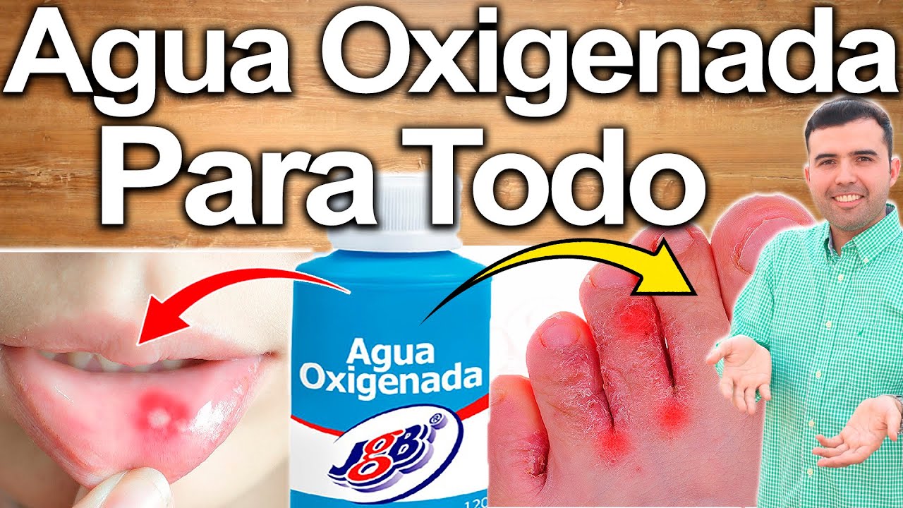 para k sirve el agua oxigenada