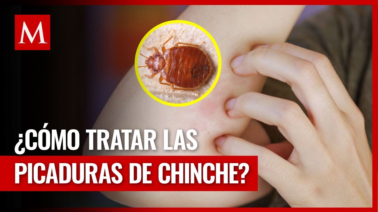 chinche de agua picadura en humanos