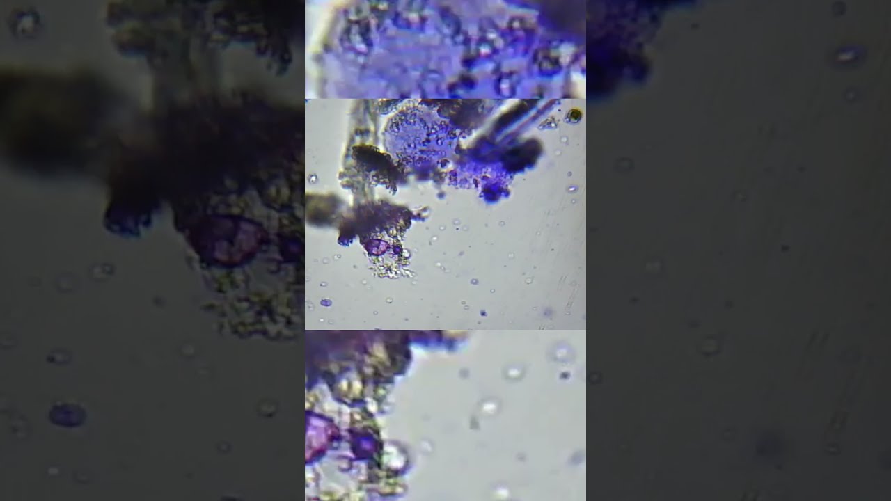 como eliminar los microbios del agua