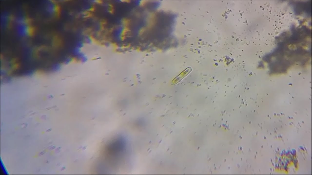un charco de agua es un ecosistema